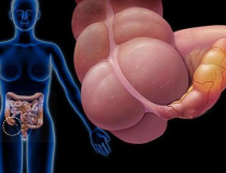 盲腸炎症狀,症狀、診斷與預防