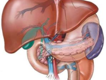 原發性肝癌早期症狀,早期識別，守護健康